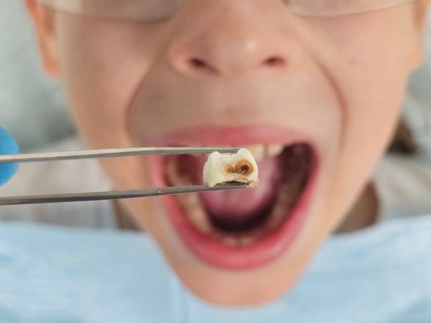 Best 24-Hour Emergency Dental Care in St John, KS